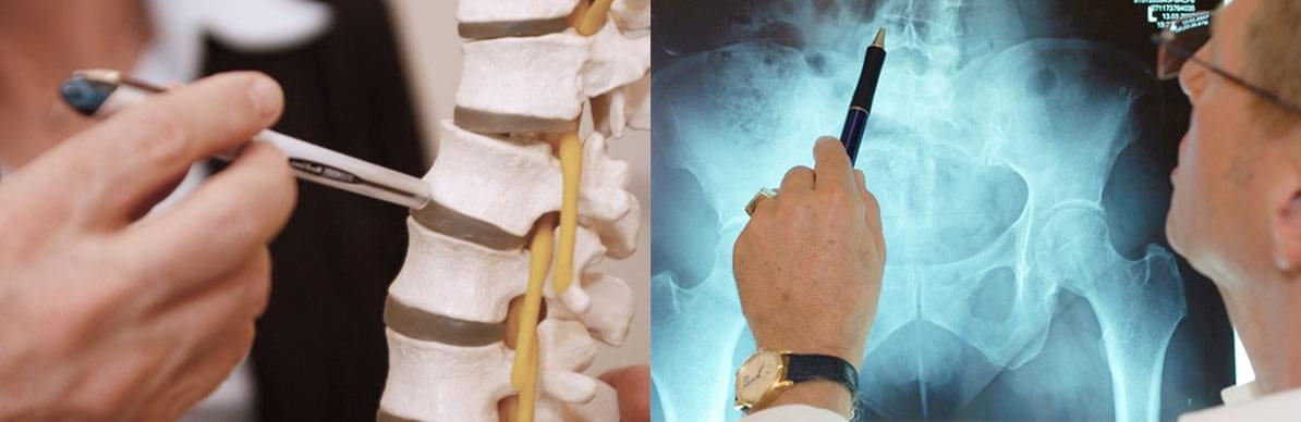 Erklärung und Röntgen – Amerikanische Chiropraxis Bischoff in Bochum
