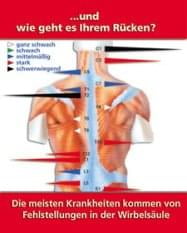 Thermoscan des Rückens